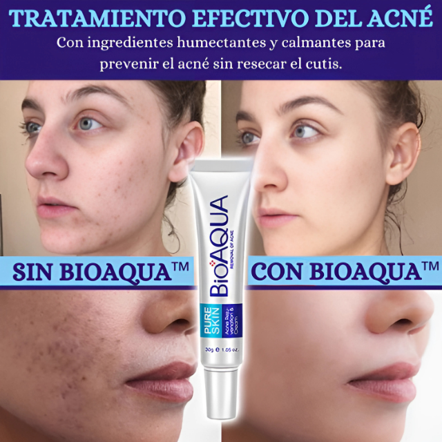 Antiacné-Bioaqua